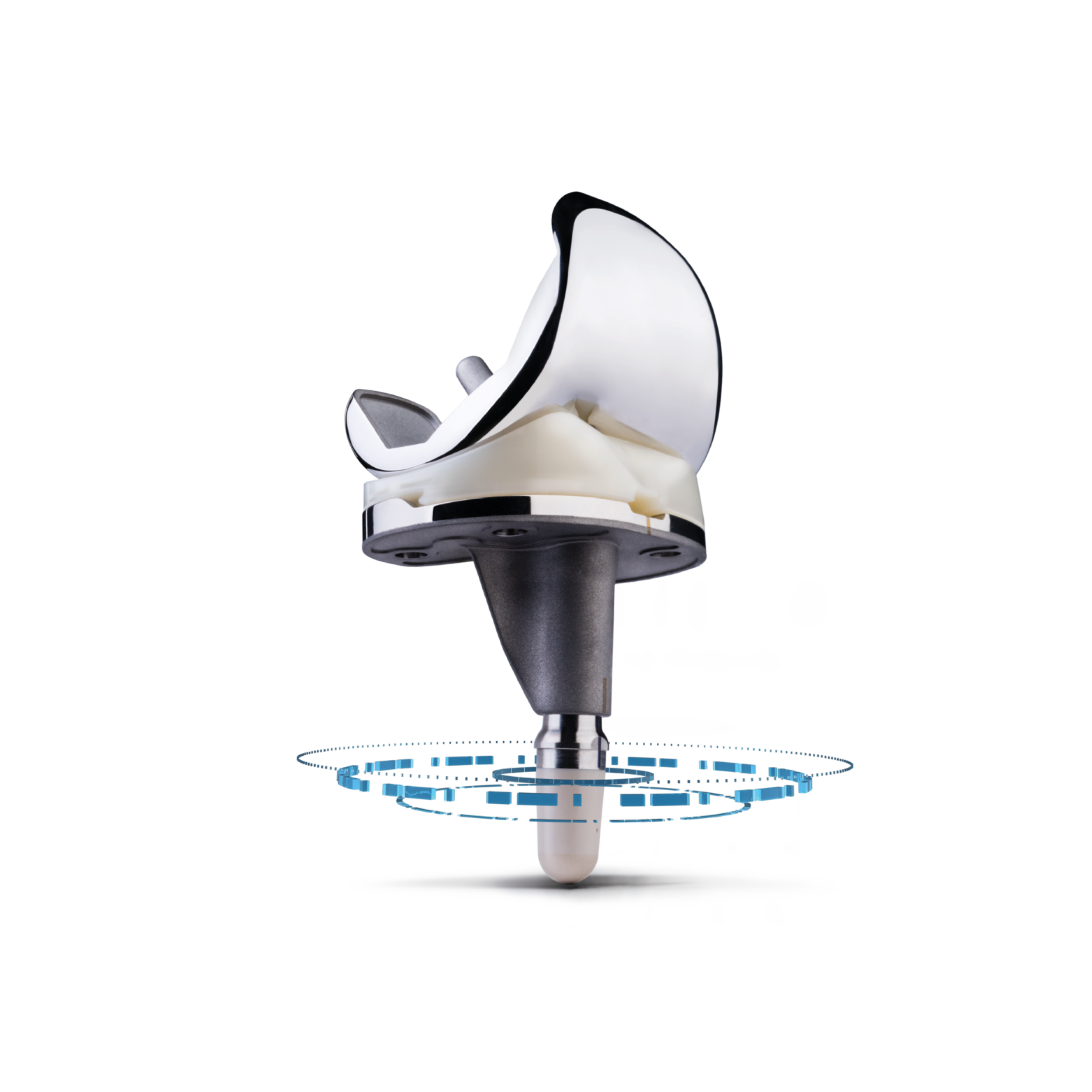 Smart Knee Implant with embedded sensors